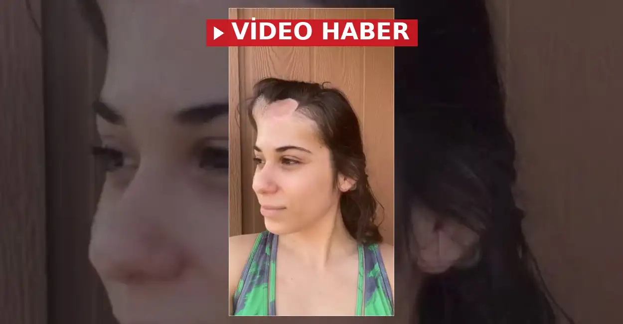 Kanserle mücadele eden bir kadın, tedavi ve iyileşme sürecindeki her