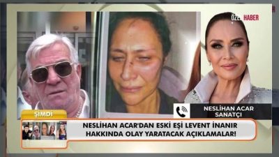 Sanatçı Neslihan Acar, yıllar sonra ortaya çıkan darp fotoğrafı ve