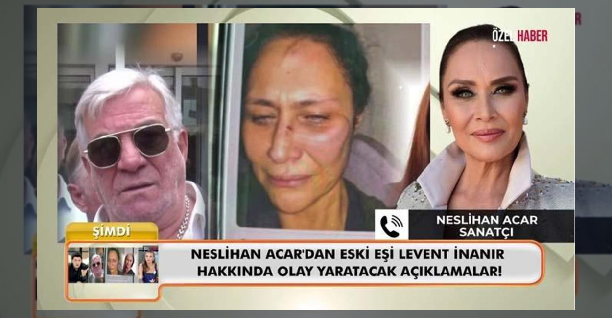 Sanatçı Neslihan Acar, yıllar sonra ortaya çıkan darp fotoğrafı ve