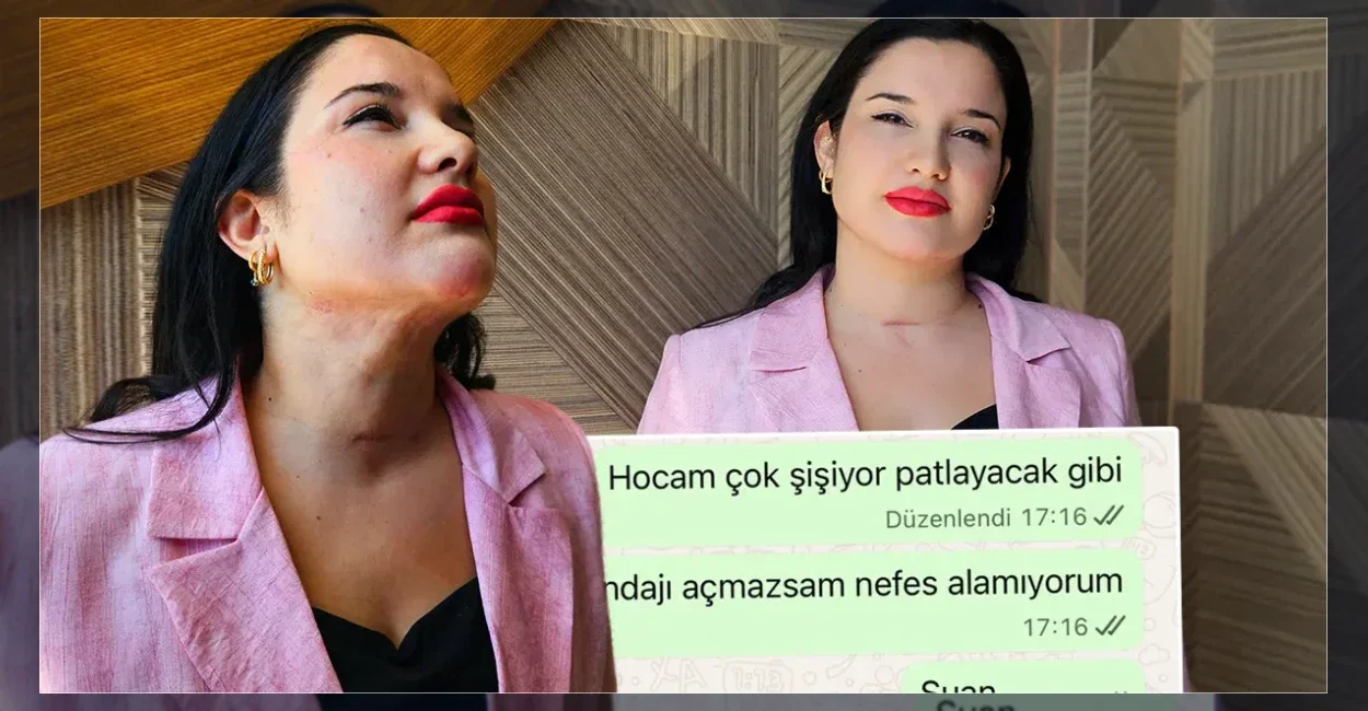 Estetik operasyon sonrası kabusu yaşadı: 5 milyon lira istiyor