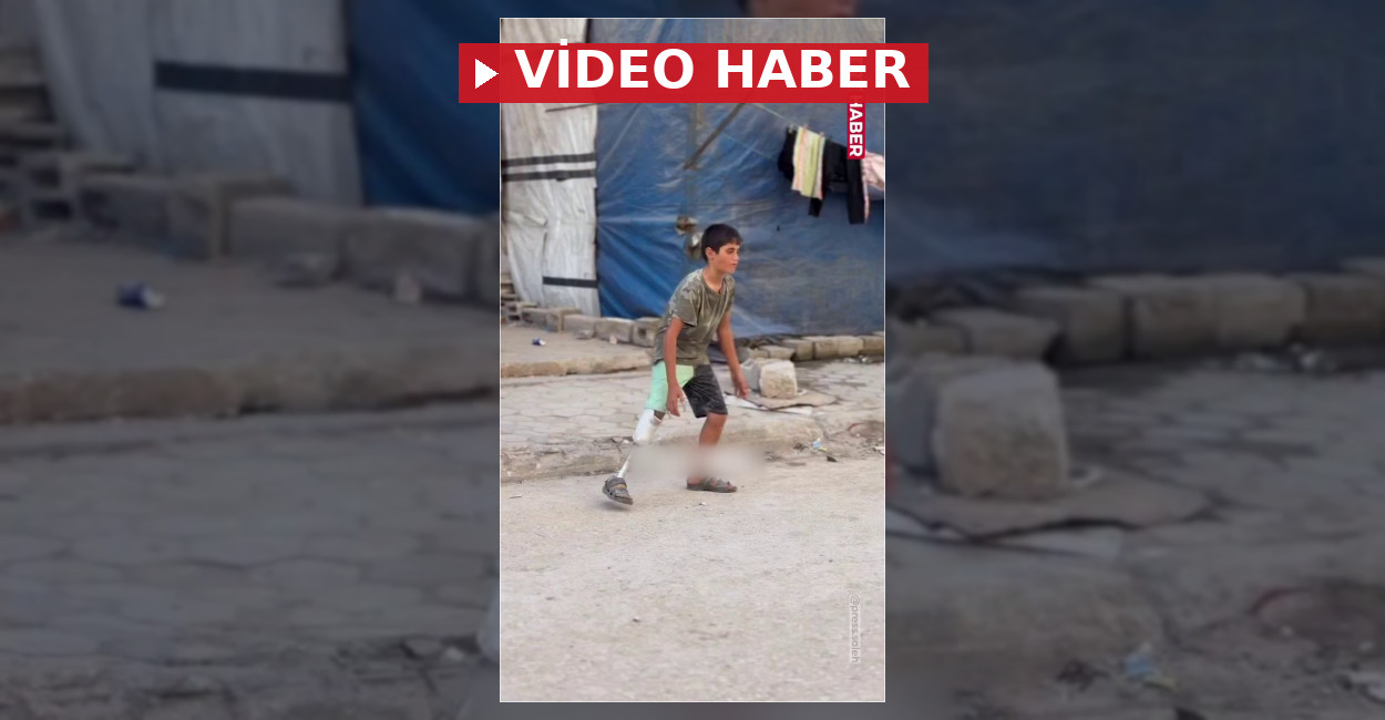 Gazze’de Saleh protez bacakla hayaline koşuyor