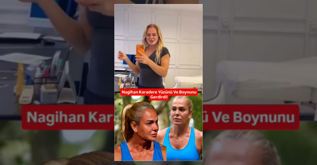 Nagihan Karadere’den Estetik Operasyon