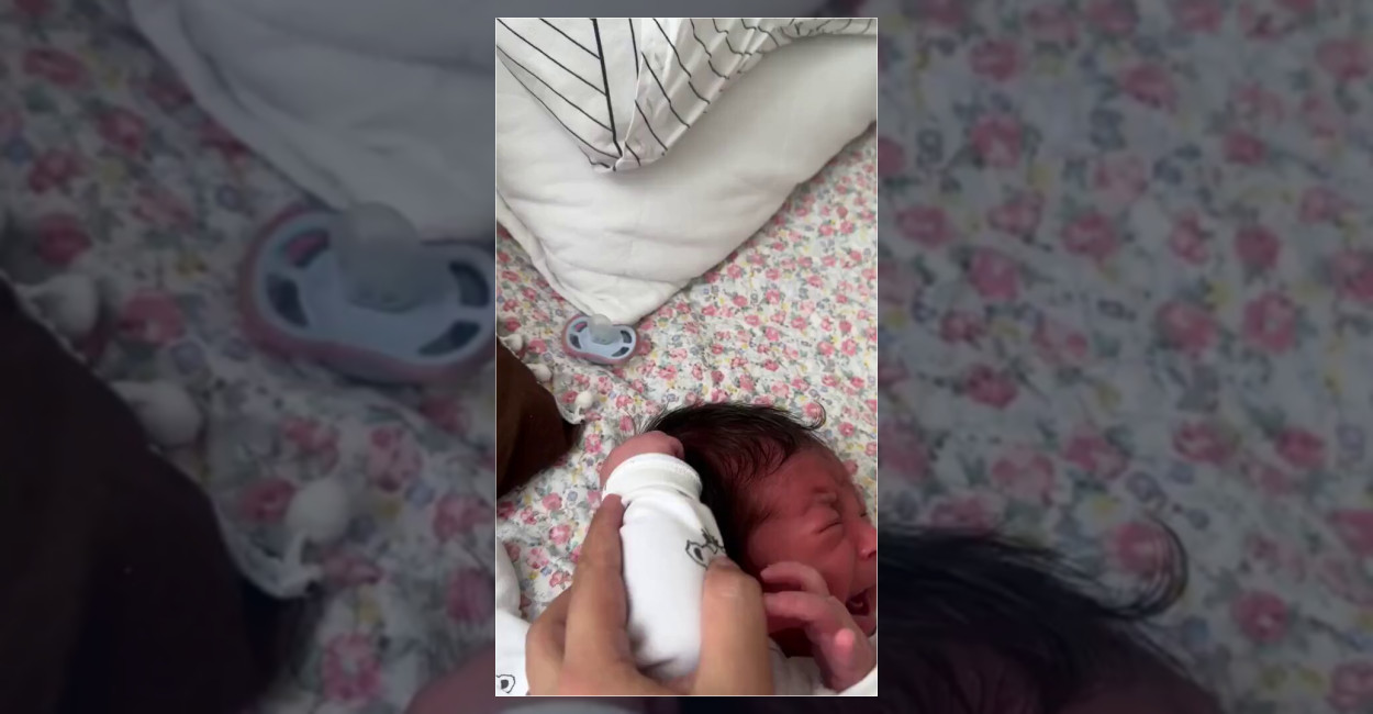 Yeni Doğan Bebek Saçını Çekti